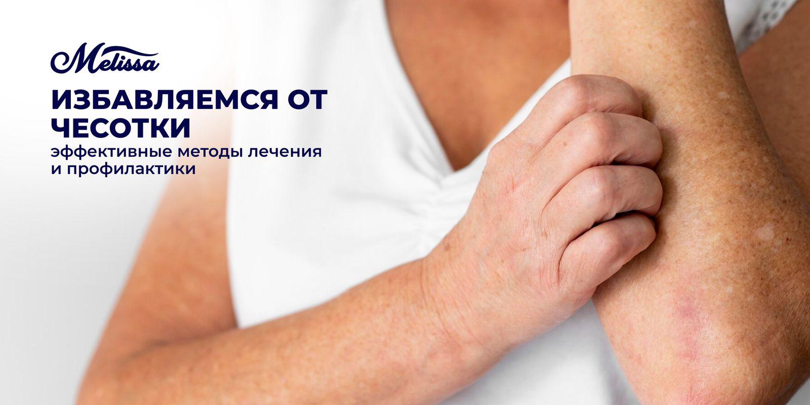 Избавляемся от чесотки: эффективные методы лечения и профилактики